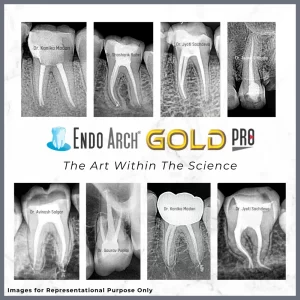 Endo Arch Gold Pro Rotary Files