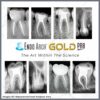 Endo Arch Gold Pro Rotary Files