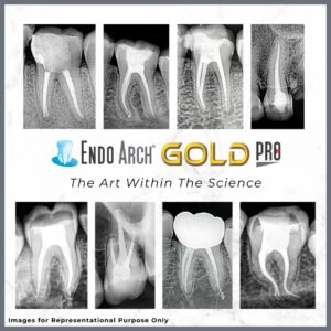 Endo Arch Gold Pro Rotary Files